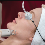 picosure pro